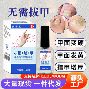 �Ҽ�Һ���ñ���Һ�Ҽ׿�����ָ�������ָֺ���㲿�o��Һ�Ҽ�șˮ