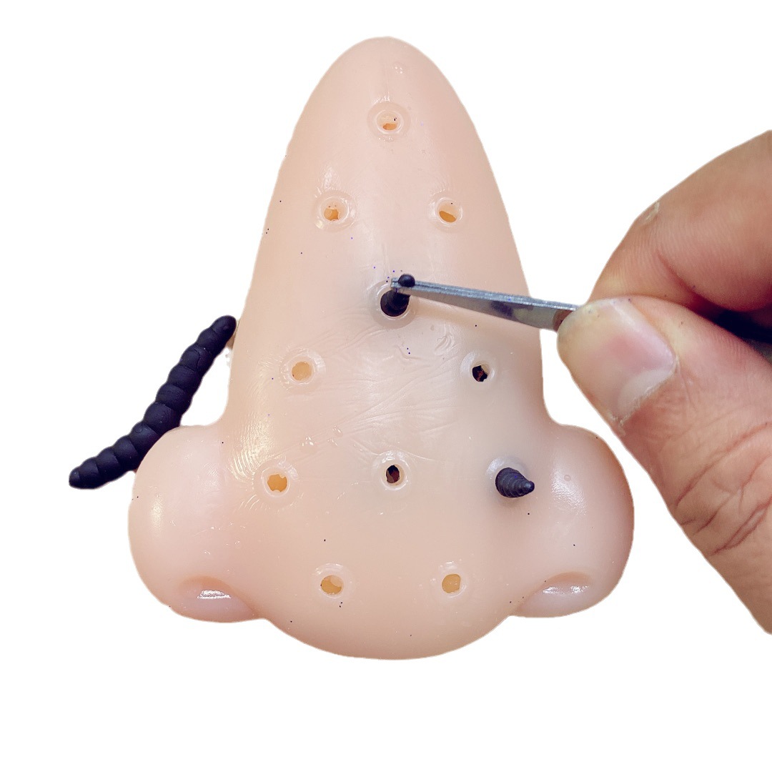 Actualizado acné squeeze ventilación juguetes repugnante truco juguetes blackhead squeeze gusano spoof juguetes en stock al por mayor