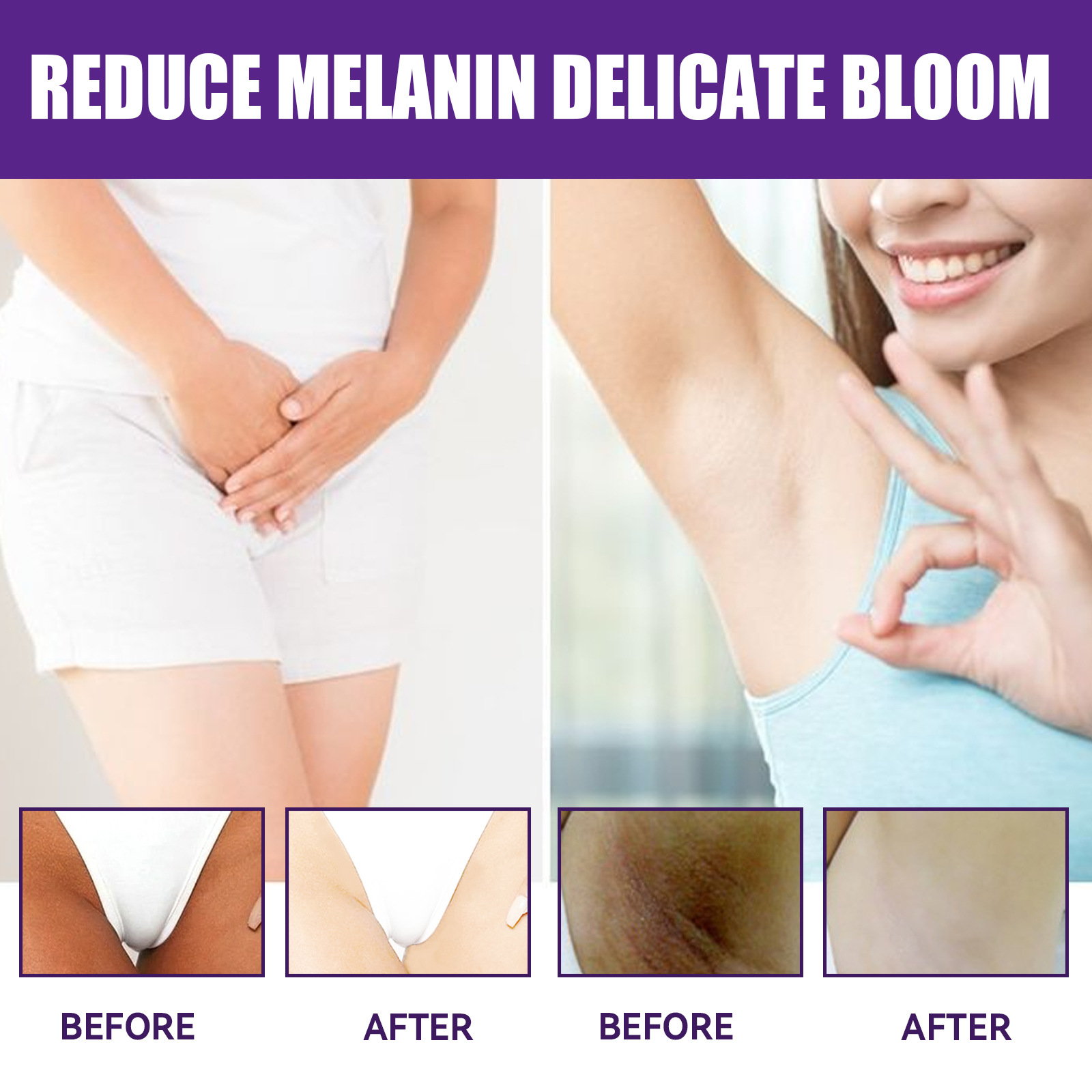 EELHOE Cremă hidratantă naturală pentru iluminare, fermitate a pielii, reduce buzele, axilele, articulațiile, melanina, cremă de albire a pielii_voghion.com