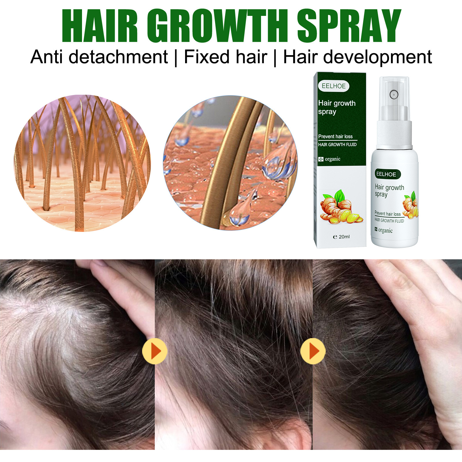 Haargroeispray voor het voeden van wortels en herstel_voghion.com