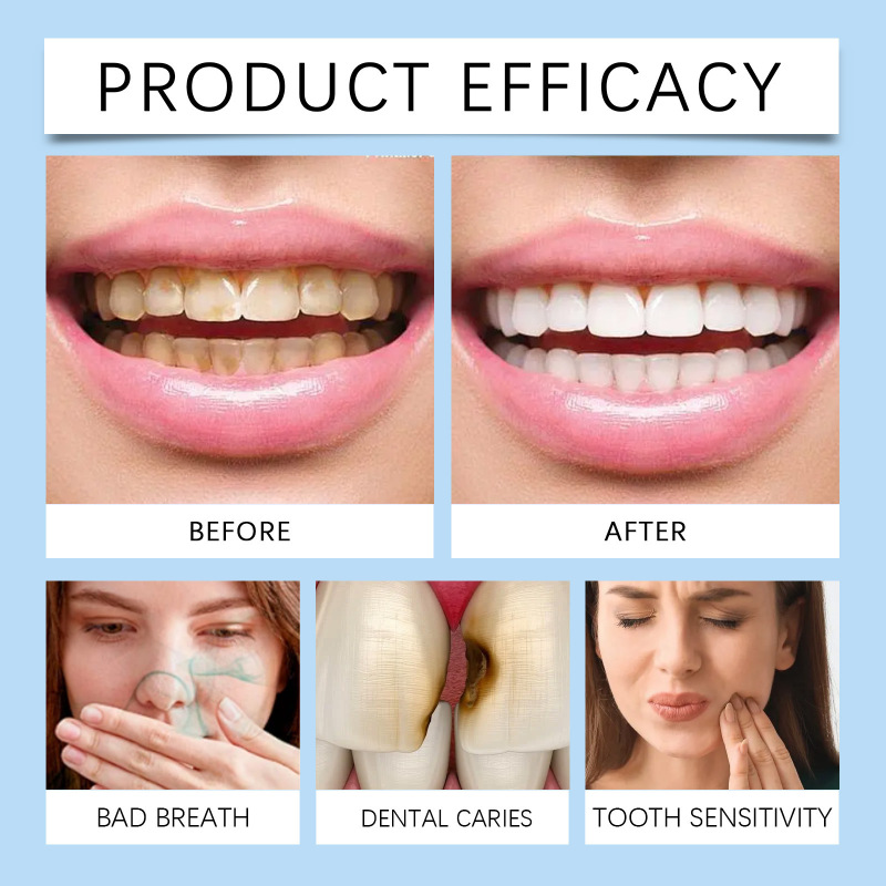 ORALHOE歯のケアは口腔の汚れをきれいにします。|undefined