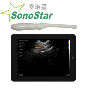 ���Z��Sonostar ���ϟo��B���ʳ�̽�^ ǻ��̽�^ �S��ֱ�Nԃ�Ά��r
