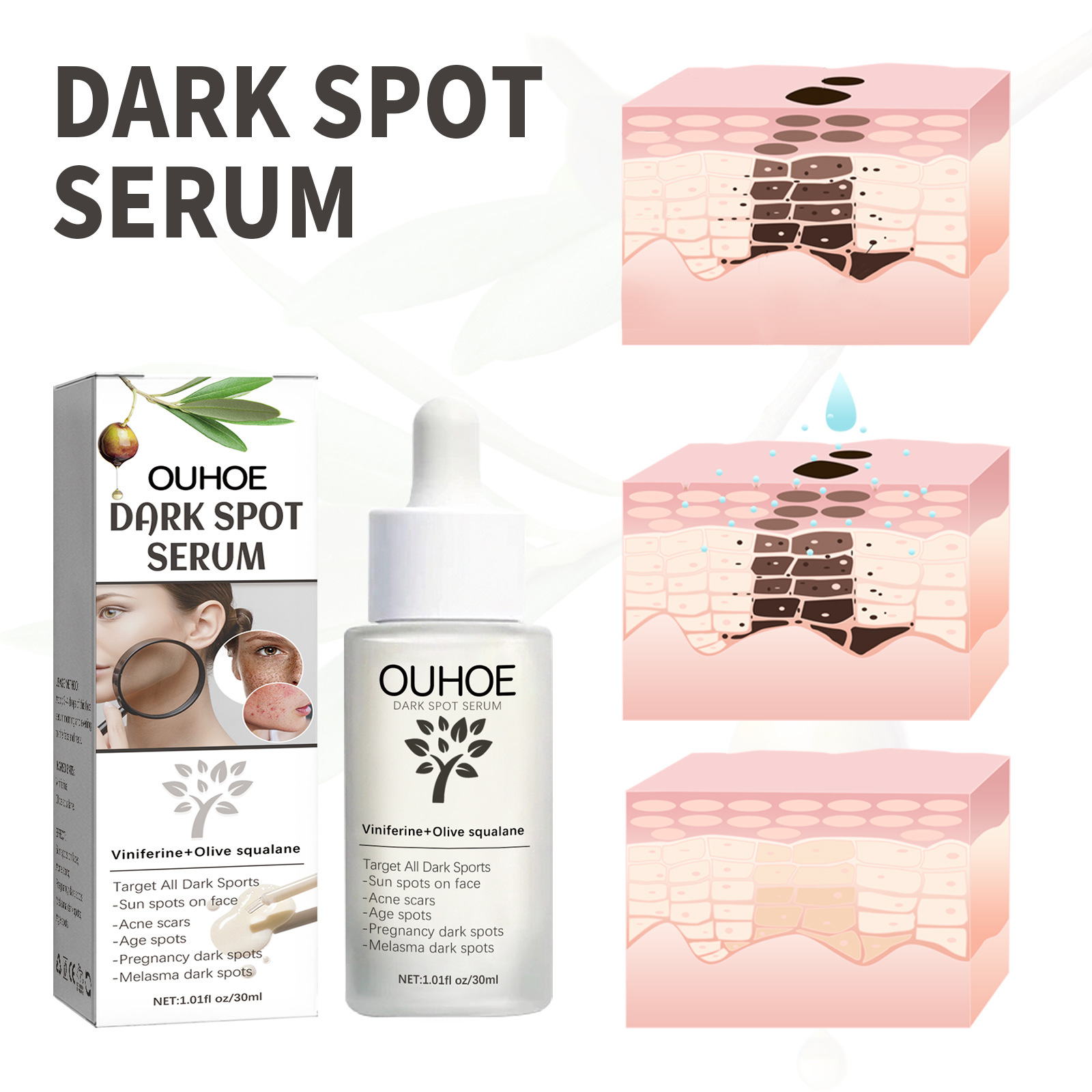 OUHOE Dark Spot&Acne för att bleka fläckar, återfukta huden, reparera aknemärken, mörka och ljusa upp ansiktets essens_voghion.com