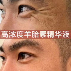 羊胎素精華液はシワの高濃度の細い紋の顔面を引き締めて水を補って保湿して明るくなります。