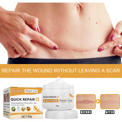 EELHOE Skin Scar Lightening Cream, Repairing Burn and Scald Lightening Cream, Surgical Repair Scar & Wound Cream, Trauma Cream