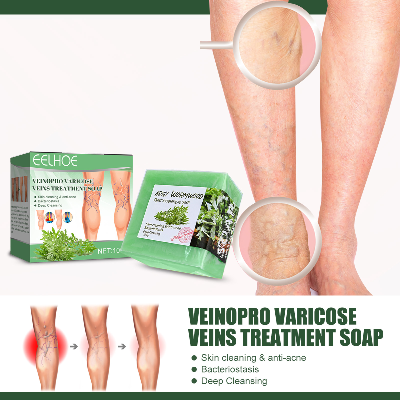 Massaggio endovenoso Eelhoe con sapone per lenire le varici, alleviare le sporgenze nelle gambe dei lombrichi e pulire il polso_voghion.com
