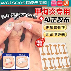 爆款指甲沟矫正贴免胶水快速修脚趾甲变形贴片脚指甲防嵌甲矫正贴