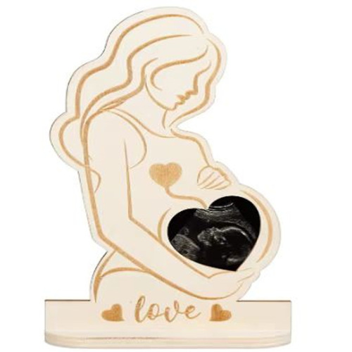 Baby Birth Commemorative Plaque: Ultrasonic Baby Scan B-Scope Keepsake for Expectant Mothers – Crafted Decorative Item