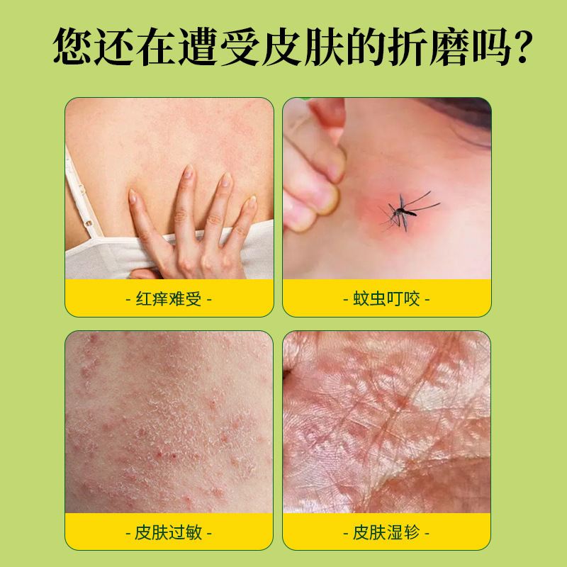现货供应 神农百草止痒抑菌膏皮肤痒藓痒湿毒外用软膏乳膏批发|undefined
