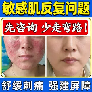 问题肌敏感肌喷雾修护红血丝激素脸退红修复肌肤屏障不挂网院线