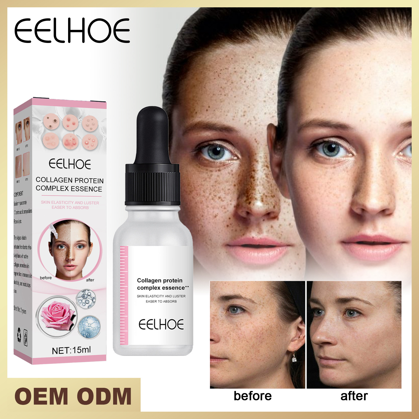 La Solution d'essence de collagène d'essence d'embryon de mouton EELHOE soulève, resserre, améliore le tonus, éclaircit les taches, hydrate et_voghion.com