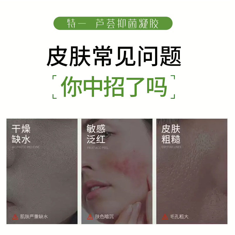 Teyi アロエベラ抗菌ジェル 15 グラム抗菌クリーム皮膚外用皮膚アレルギーかゆみ保湿塗布スキンケア|undefined