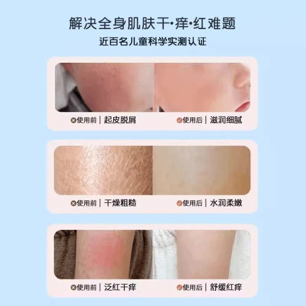 Children's vaseline