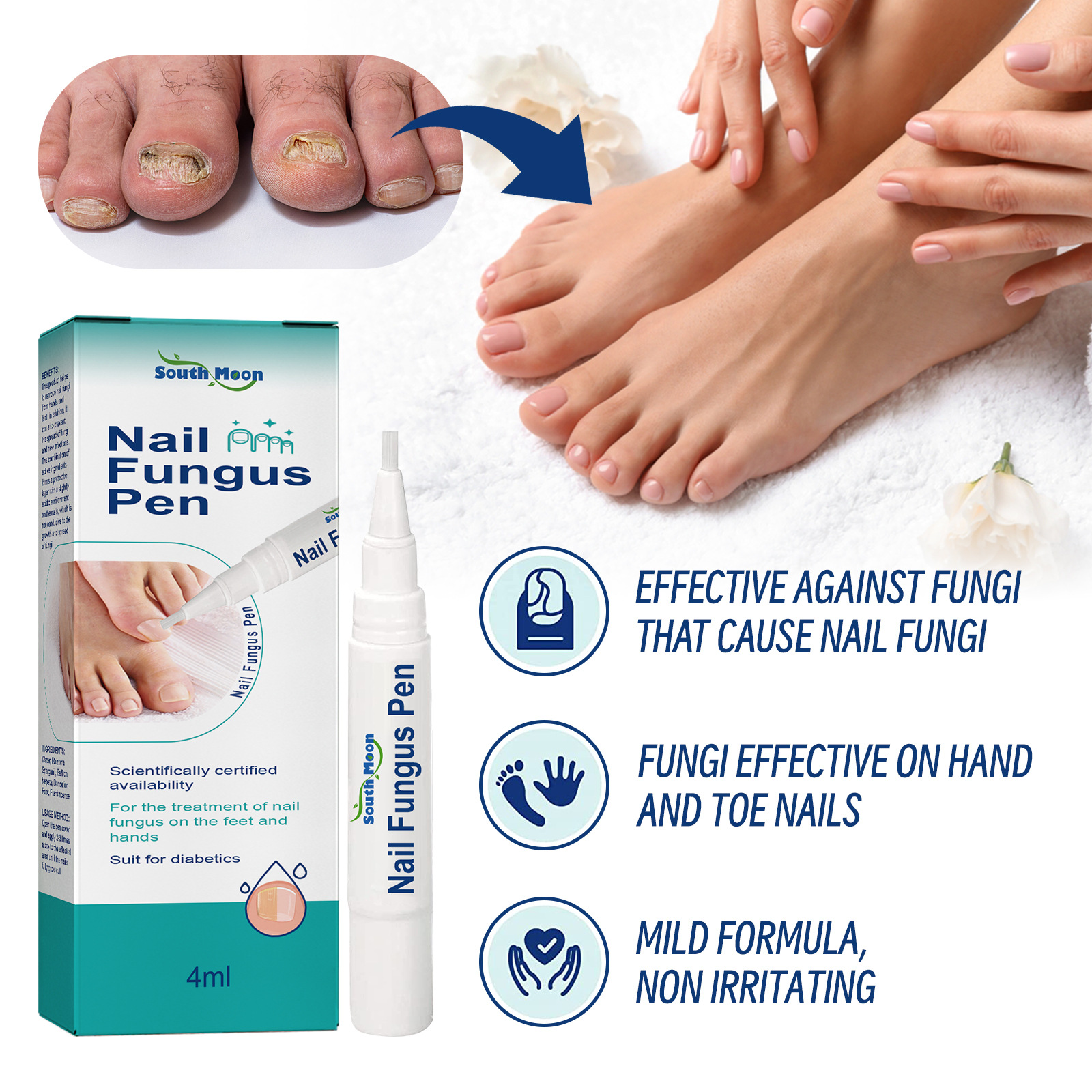 Stylo de réparation South Moon répare les mains et les pieds gris ongles doux brillants épaississement de la Surface des ongles soin hydratant_voghion.com