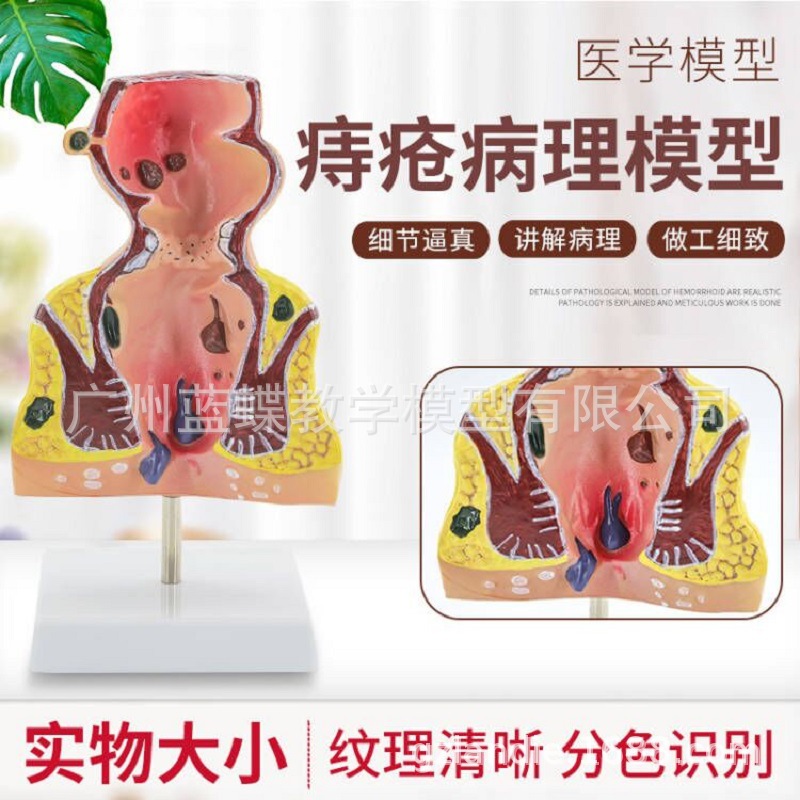 רҵ�ع�ֱ������ģ�� ����ֱ������ģ�� ��¥̽�� �̴�ģ�� ����