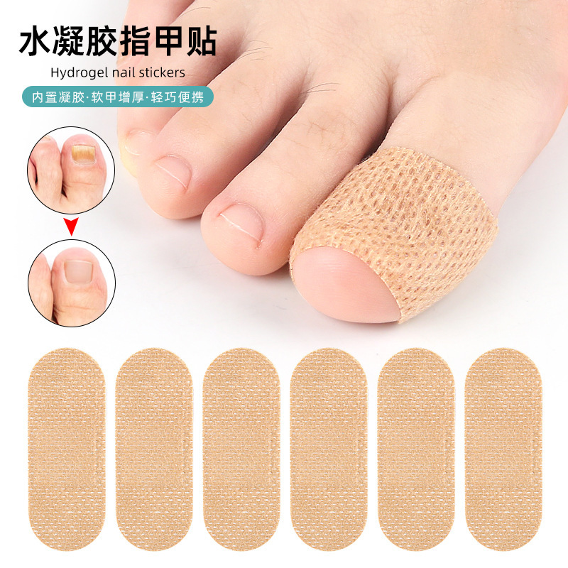 Amazon Hydrogel Oval Nail Repair Patch Toenail Patch Soft Nail Ingrown Nail Thickening Nail Patch