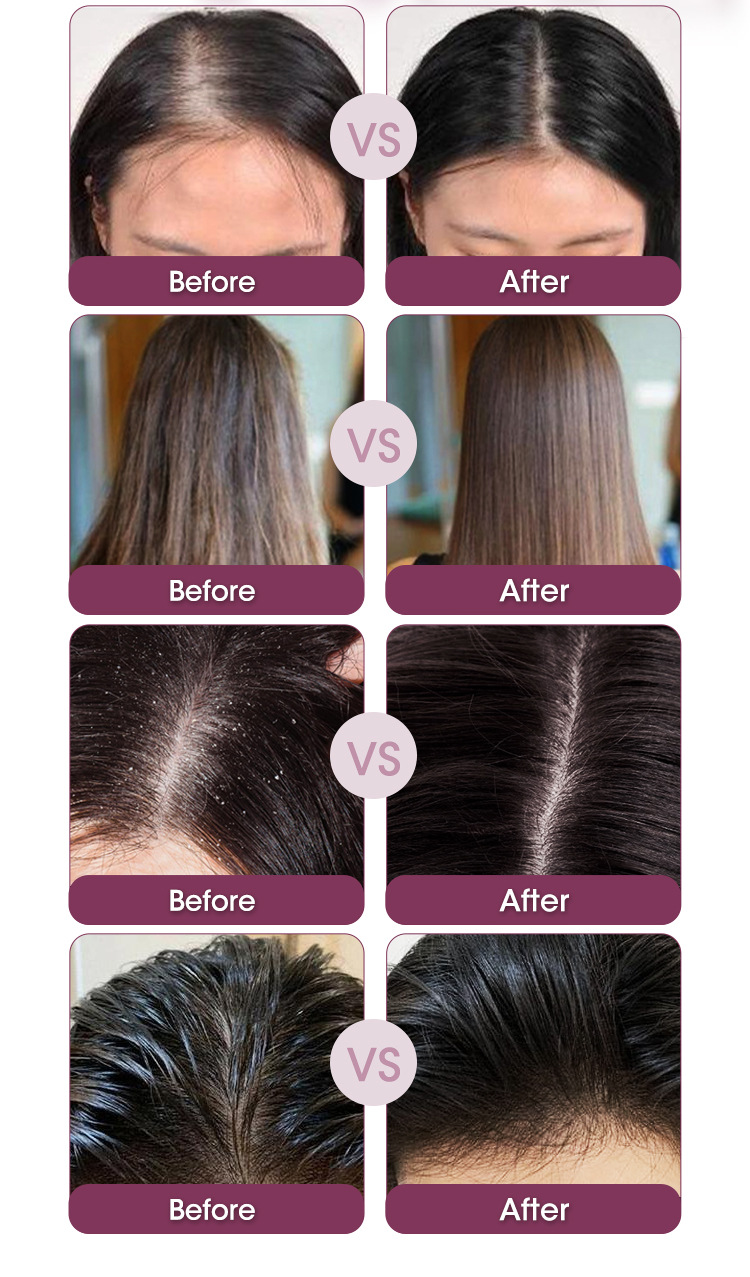 Set Completo de Cuidado Capilar