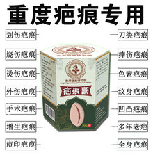 ۴ș̺۸g̺۰͹ˤC̺۶ӡޏ͸