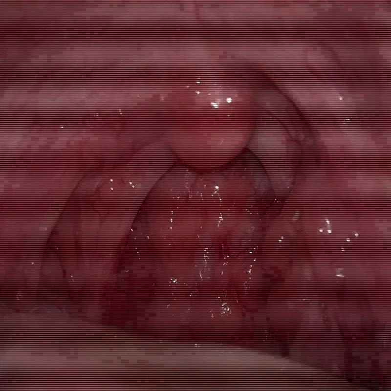 Inflatable Doll Male Real-Life Version Full Body Foldableable with Pubic Hair Semi-Solid Intelligent Silicone Doll Adult Products