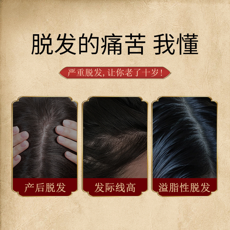 姜約防脫育發液套盒增發密發草本生薑育發精華液防掉發育發液批發