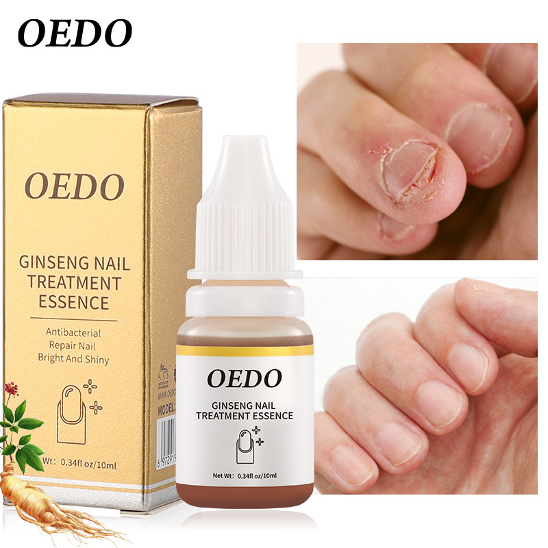 Cross-border OEDO ginseng nail essential...