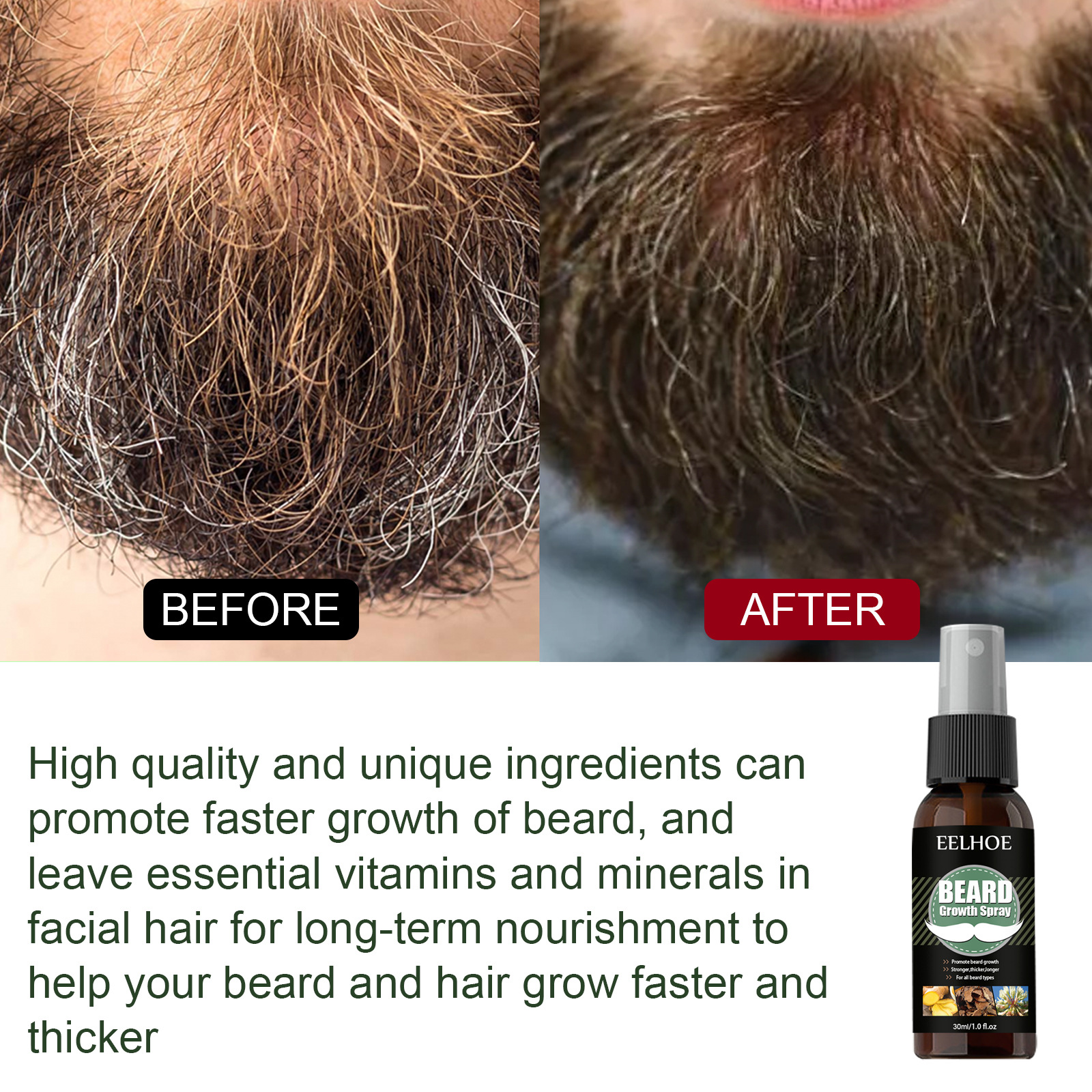 EELHOE Beard Growth Spray