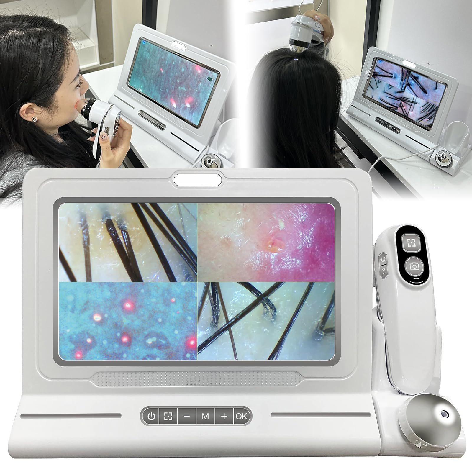 11inch 고화질 두피 모발 검사기 미용 및 헤어 전용 고화질 피부 검사기 화면 포함