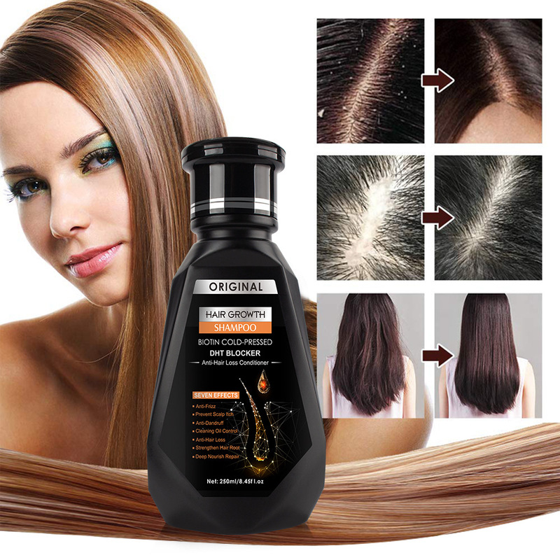 クロスボーダー生姜シャンプー清潔髪髪髪髪ヘアケア新バージョン卸売Hair growth shampoo|undefined