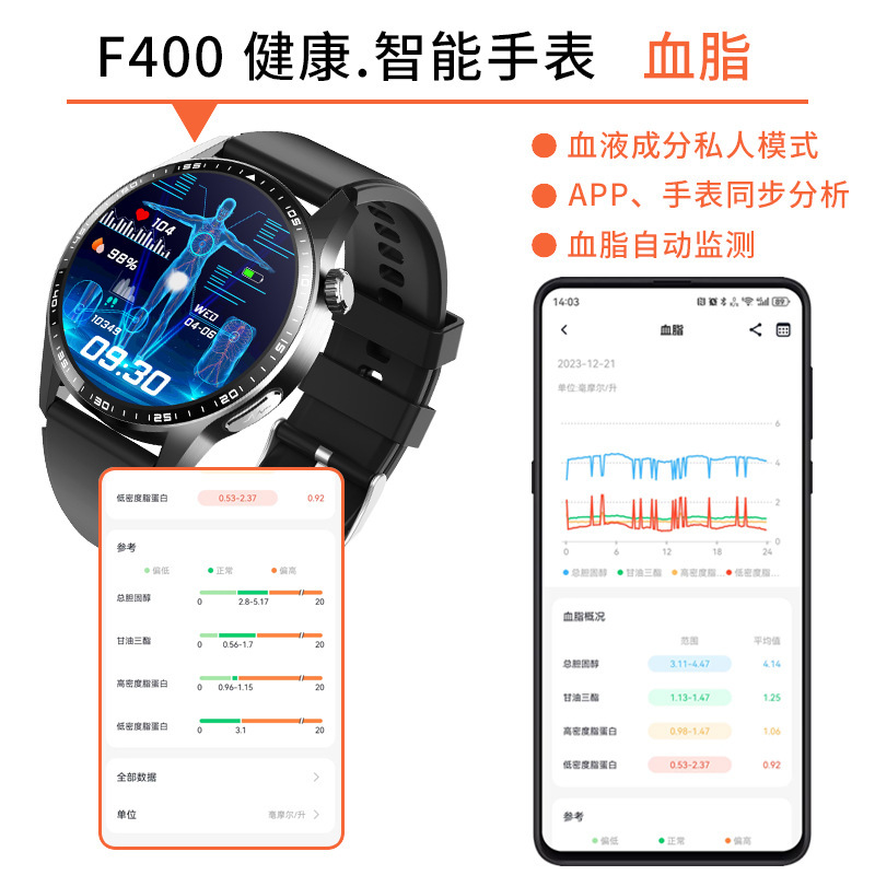 智能健康手表W400心电ECG尿酸血脂血糖SOS高清高色域屏智能手环|undefined
