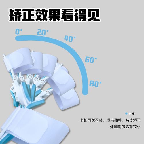 Hallux valgus correction, toe fixation, mechanical knob adjustment, hallux valgus separation and split toe corrector