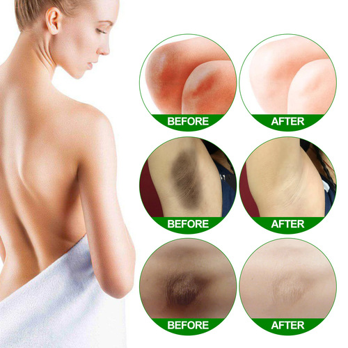 EELHOE Skin Beauty Cream Skin Brightening and Diminishing Melanin Joints Elbows and Armpits Moisturizing Skin Care Cream