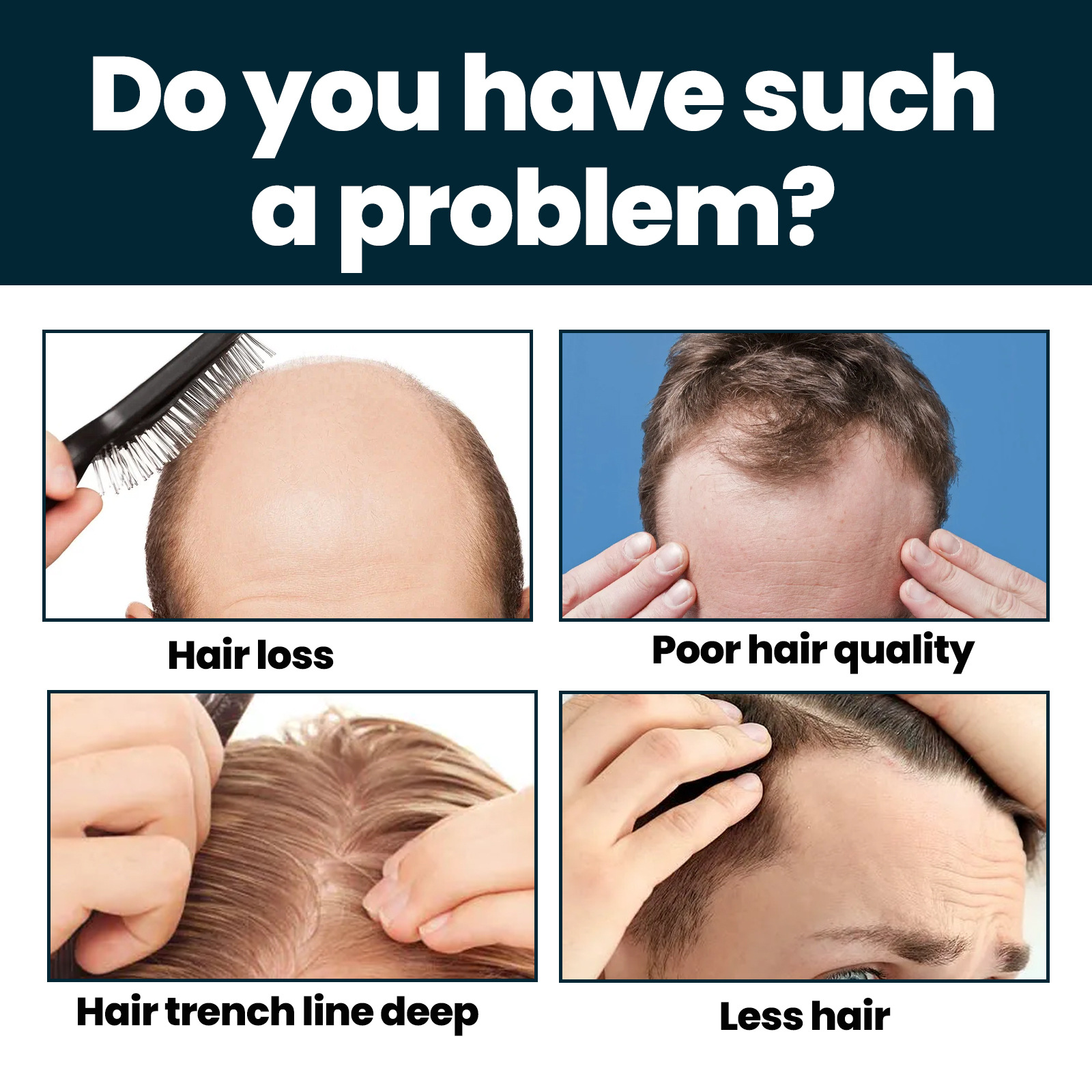 Moon Lotion East Mænds nærende pleje Anti-droppe fast hår Tæt fugtgivende essens_voghion.com