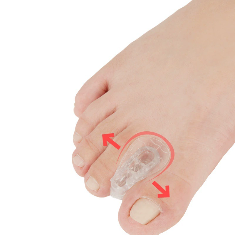 Toe Separator Clip, Transparent Overlapping Toe Spacer, One Size Soft Spacer