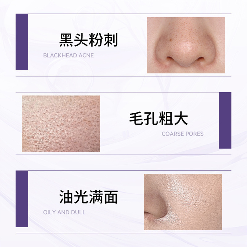 紫苏清洁泥膜收缩毛孔去黑头粉刺水杨酸深层清洁面部涂抹式面膜|undefined