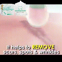 La crema reparadora y aclaradora de cicatrices EELHOE elimina cicatrices de quemaduras, cicatrices antiguas, cicatrices posoperatorias, crema reparadora y suavizante de la piel (paquete de 2)_voghion.com