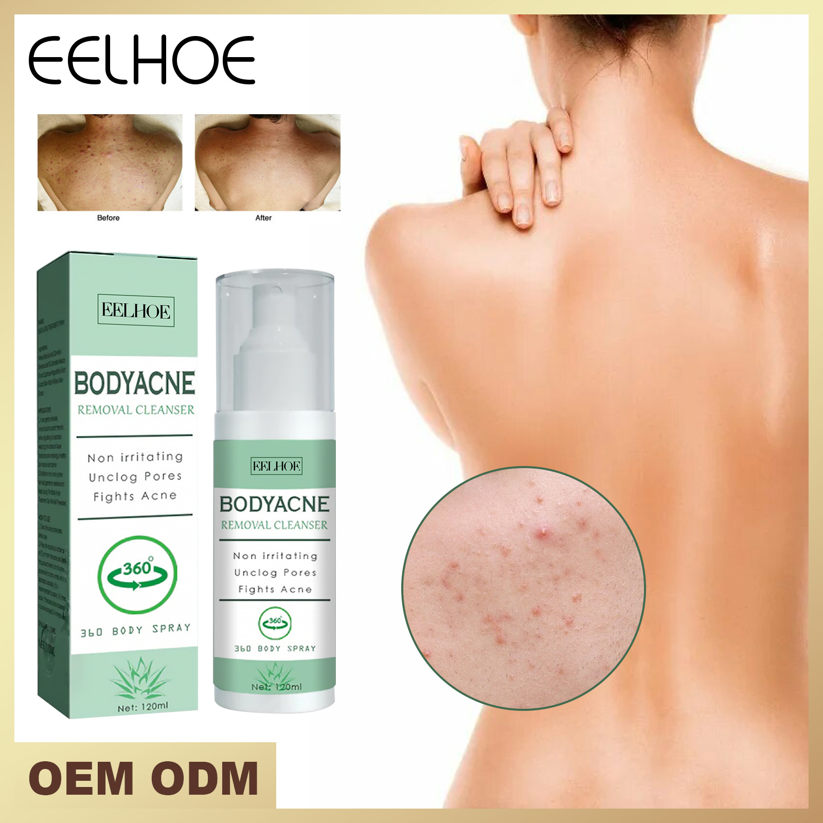 EELHOE Body Removing Cleaning Nettoie en profondeur le dos du bras pour éclaircir et l’acné Spray hydratant_voghion.com