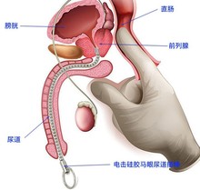 SAT4sm弹头拉珠马眼棒金属不锈钢尿道堵可弯曲阴茎插棒男用快感性