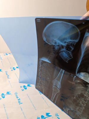 14x17 Blue на основе Blue Thermist Film Ct CR DR MRI Атомная магнитно -резонансная радиология Медицинская пленка облачное море