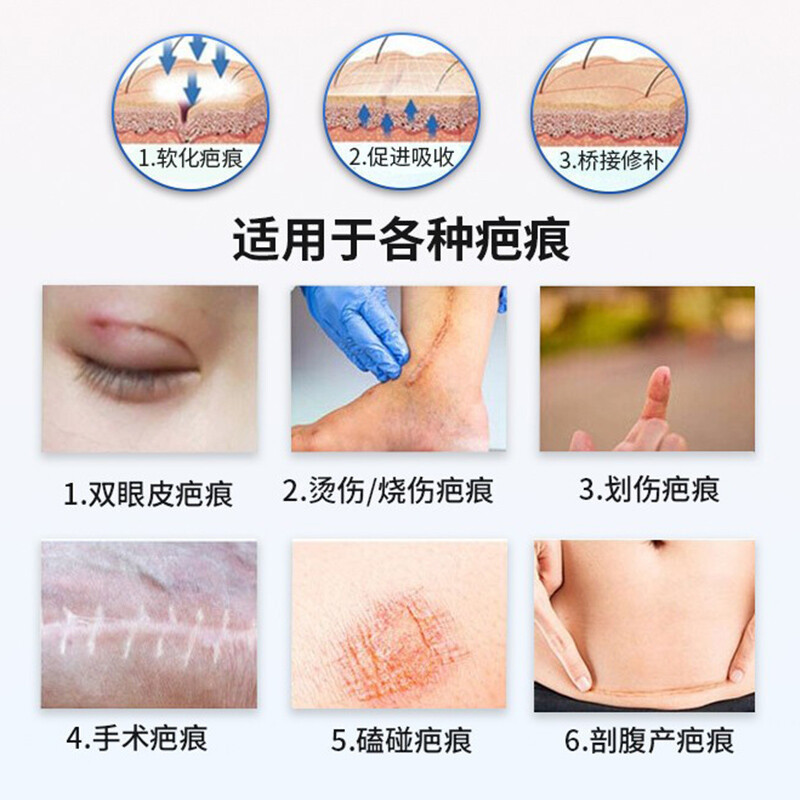 Scar Repair Ointment Scald Repair Ointment Repair of Scar genuine goods Surgery Scar Hyperplasia Repair Ointment Dispelling Scar Ointment