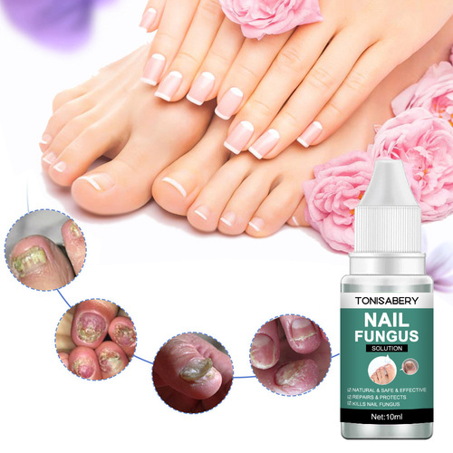 TONISABERY cross-border foreign trade export onychomycosis repair and nourishing solution brightening essence