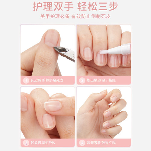 Bodybuilding Chuangyan Nail Nutritional Oil, Nail Oil, Finger Edge Manicure Nourishing Pen Liquid, Exfoliating Dead Skin, Anti-Barb Edge Care