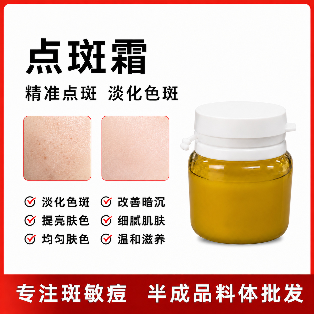 Powerful non-irritating spot-removing cream for beauty salons, for freckles, age spots, chloasma, sun spots, whitening and spot-removing cream