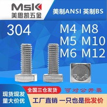 304PGB35ķ^˨^ݽzĽݗUM5M6M8M10mm