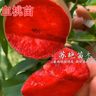 �������Ѫ����޽�����t��Ѫ�Ҙ���t�������ҹ������Ϸ������N