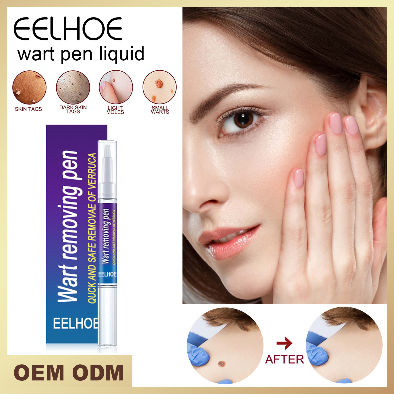 Eelhoe Skin Care Solution Pen Gentle Cleansing Skin Care Body Face Label Meat Grain Solution