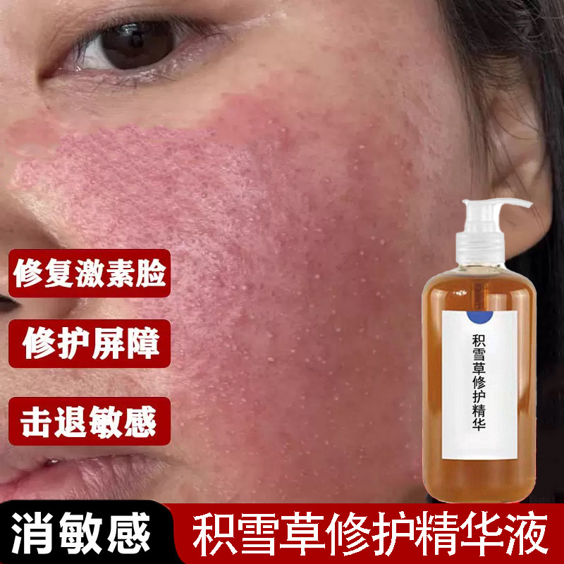 积雪草修复精华液修复敏感肌增厚角质层激素脸修复去红血丝精华液