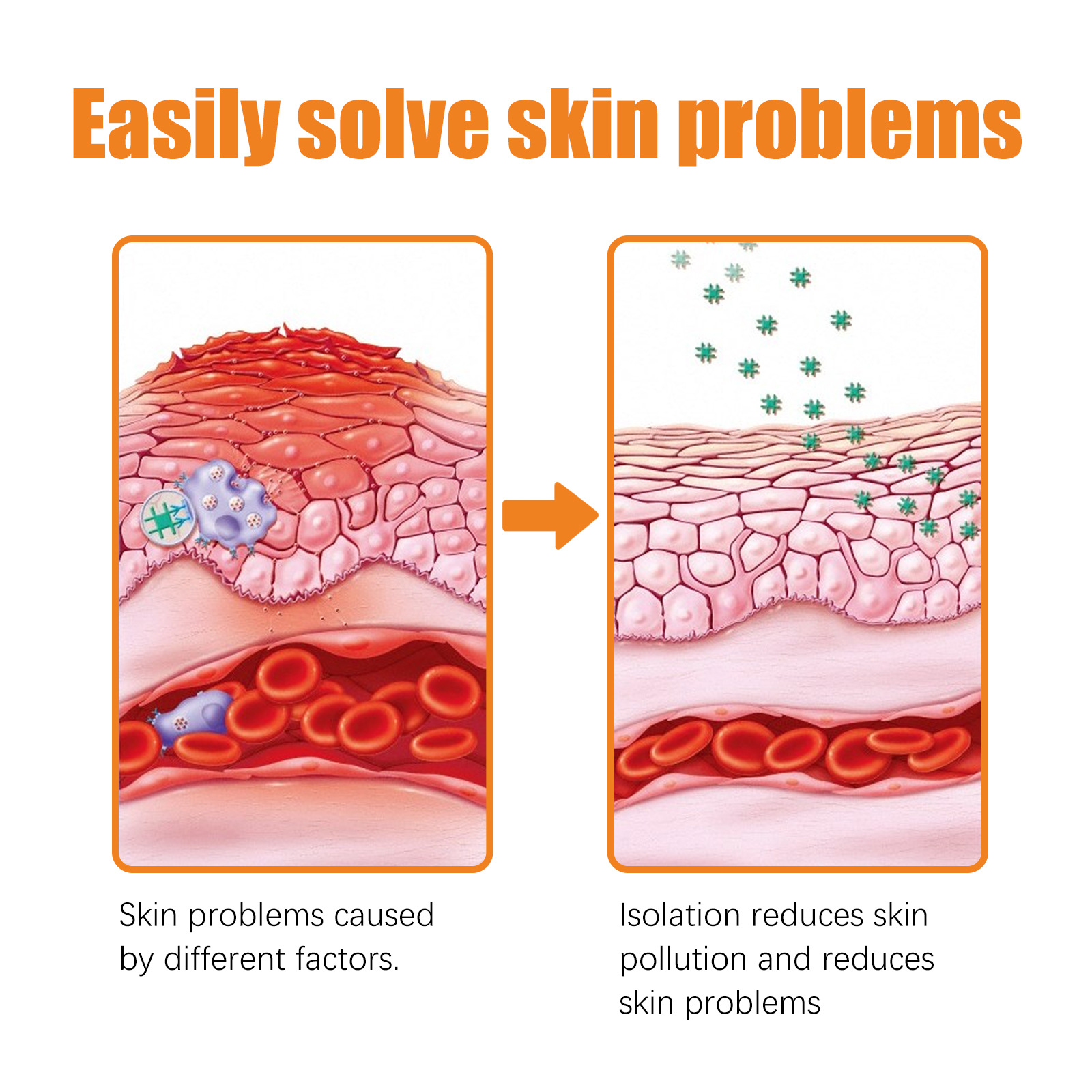 South Moon Skin Repair Cream relieves skin itching, repairs hand and foot, moisturizes skin and relieves itching care_voghion.com