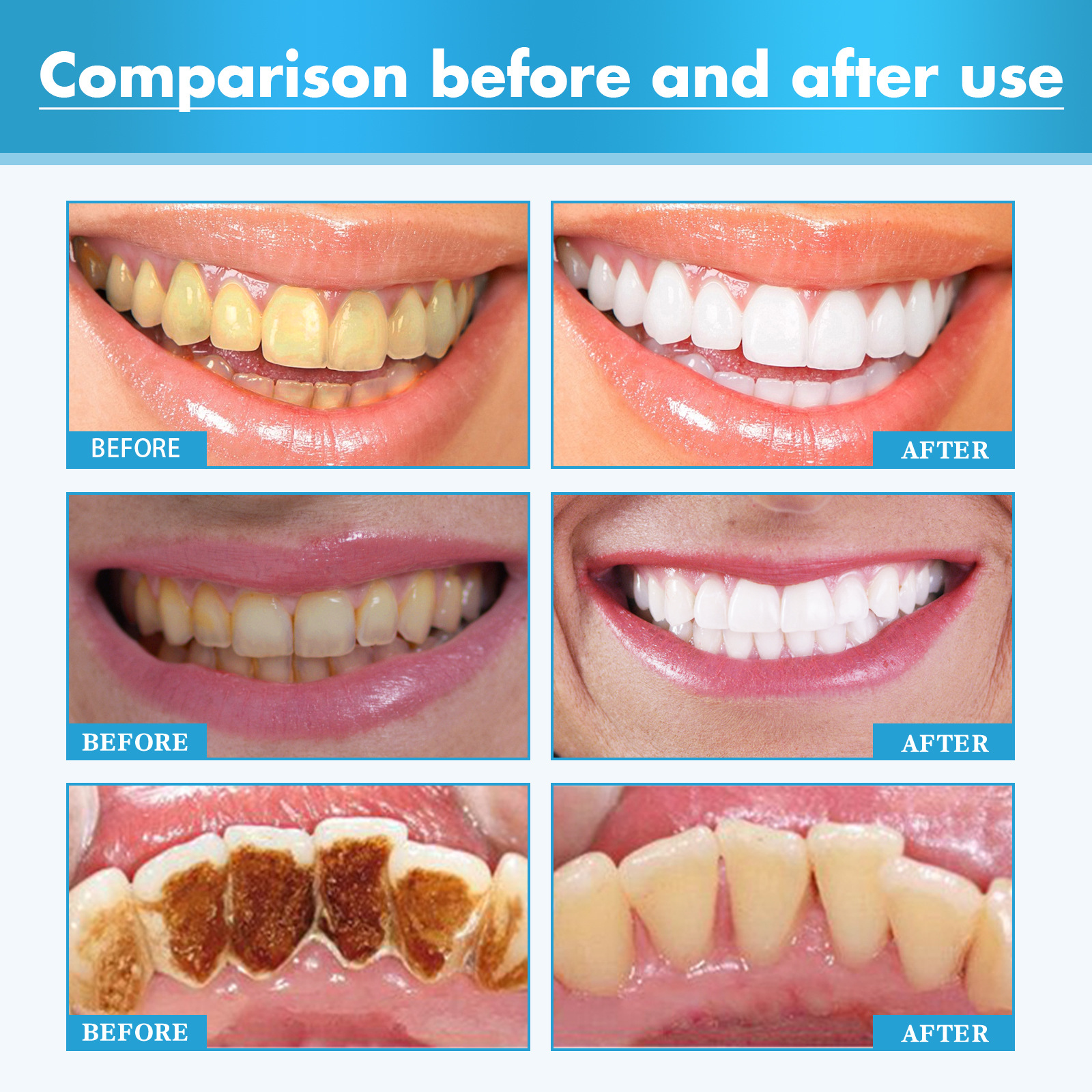 Herbal Toothpaste Mousse For Teeth Whitening And Oral Cleansing_voghion.com