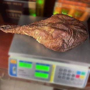 �����خa¹̥����÷��¹���c¹̥����Ѫ̥��ֻ���rȫ¹������