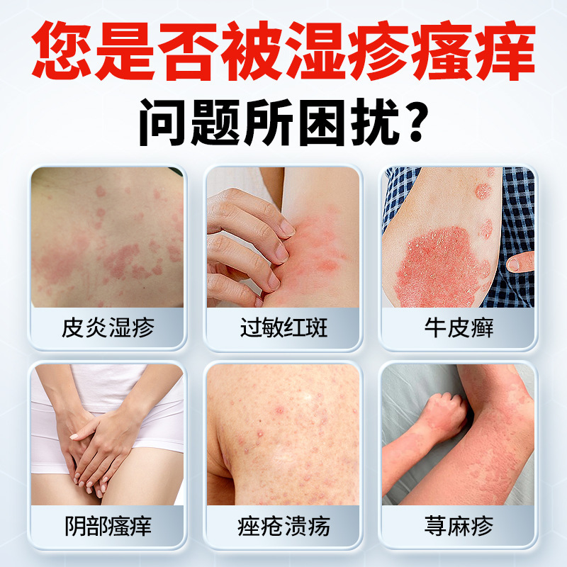 南京銅仁堂皮膚かゆみ止めスプレー乾癬蕁麻疹発疹性アクネ皮膚炎陰部かゆみ湿疹クリーム|undefined